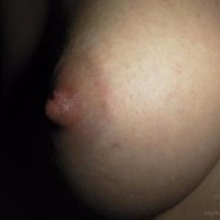 My Nipples