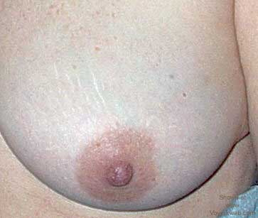 Pic #1*NC Wife's Nipples