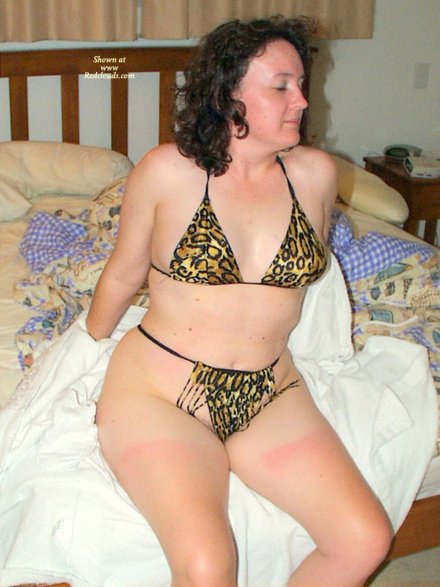 Pic #1Yummy Mummy After Too Much Sun