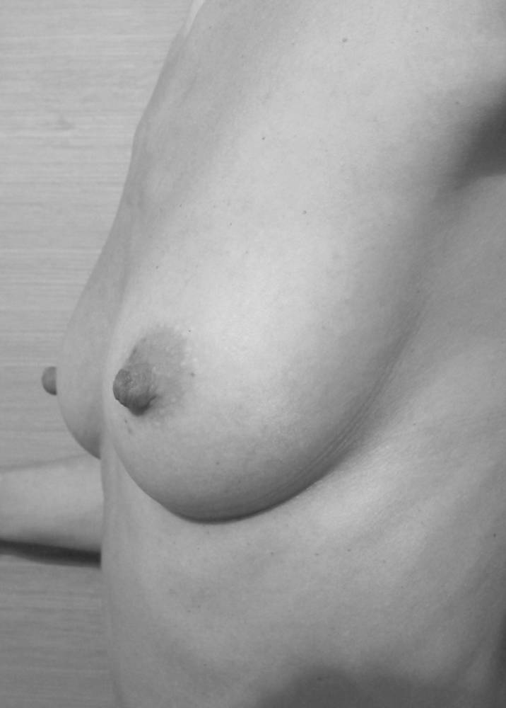 Pic #1 My medium tits - Russian Nurse