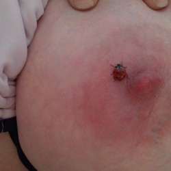 Medium tits of my girlfriend - japot - ladybug takes a walk....